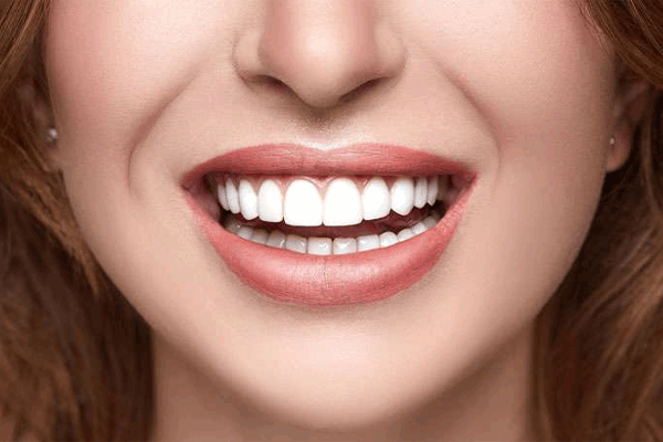 La sonrisa como punto clave en la mejora de la estética global