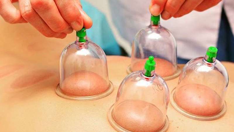 Cupping, equilbrio no corpo e mente