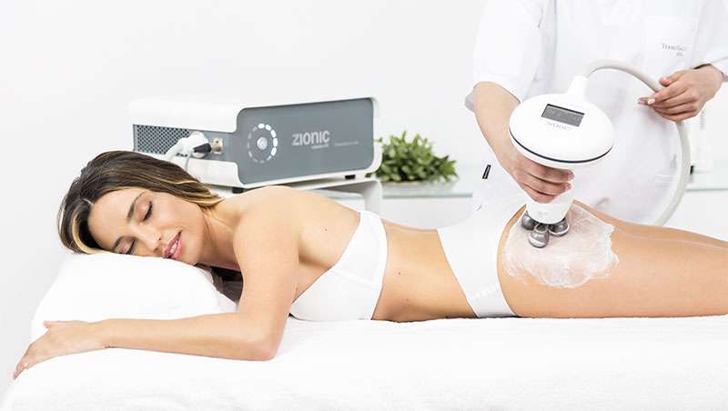 Zionic, el tratamiento estrella en bodycontouring