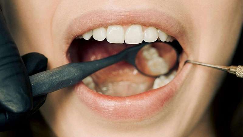 Una mala salud bucodental puede ser un factor de riesgo a nivel mental y viceversa